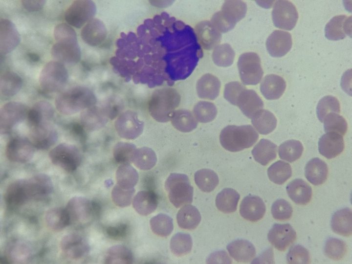 Blood smear, horse eosinophil with giant rounded granules in the cytoplasm