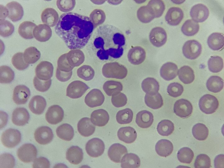 Blood smear, dog eosinophil and neutrophil with a segmented nucleus