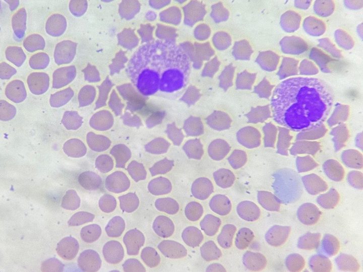 Blood smear, cat eosinophils with typical rod-shaped granulation