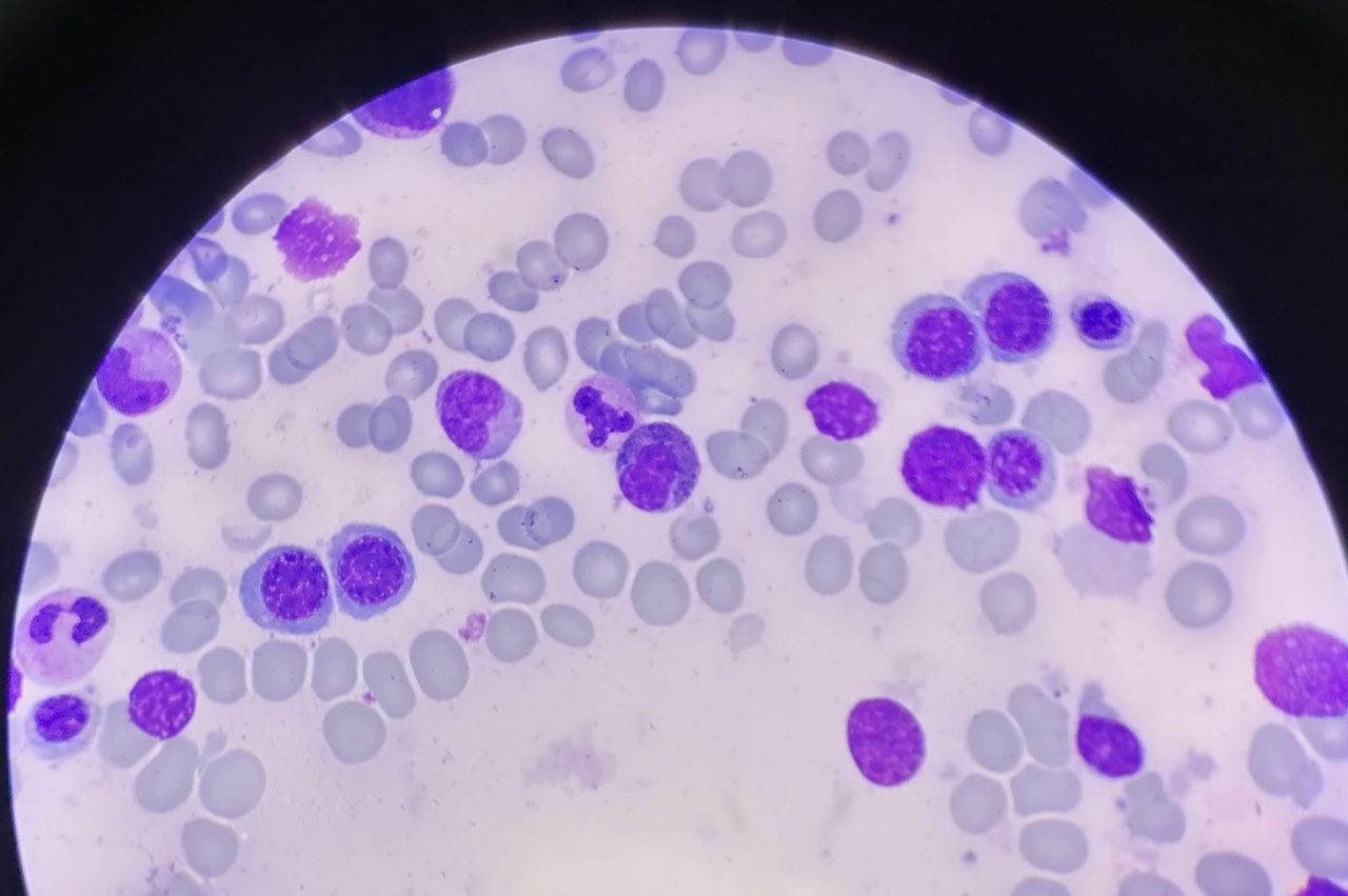 Erythrocyte Morphology in Active Erythropoiesis