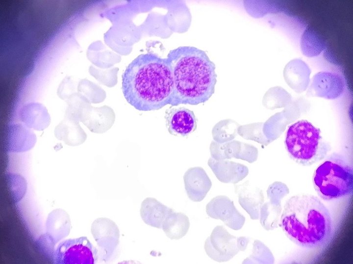 Bone marrow smear: a pair of erythrocaryocytes with an intercytoplasmic bridge