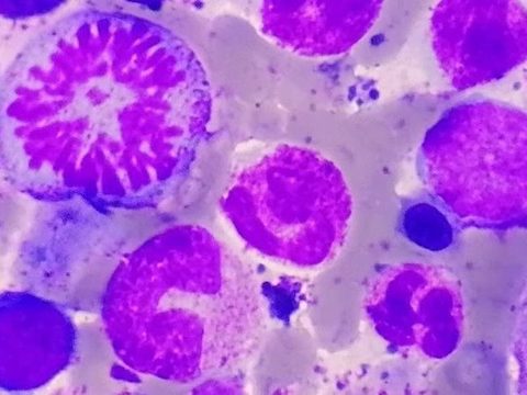 Bone marrow smear: mitotic figure surrounded by granulocytes