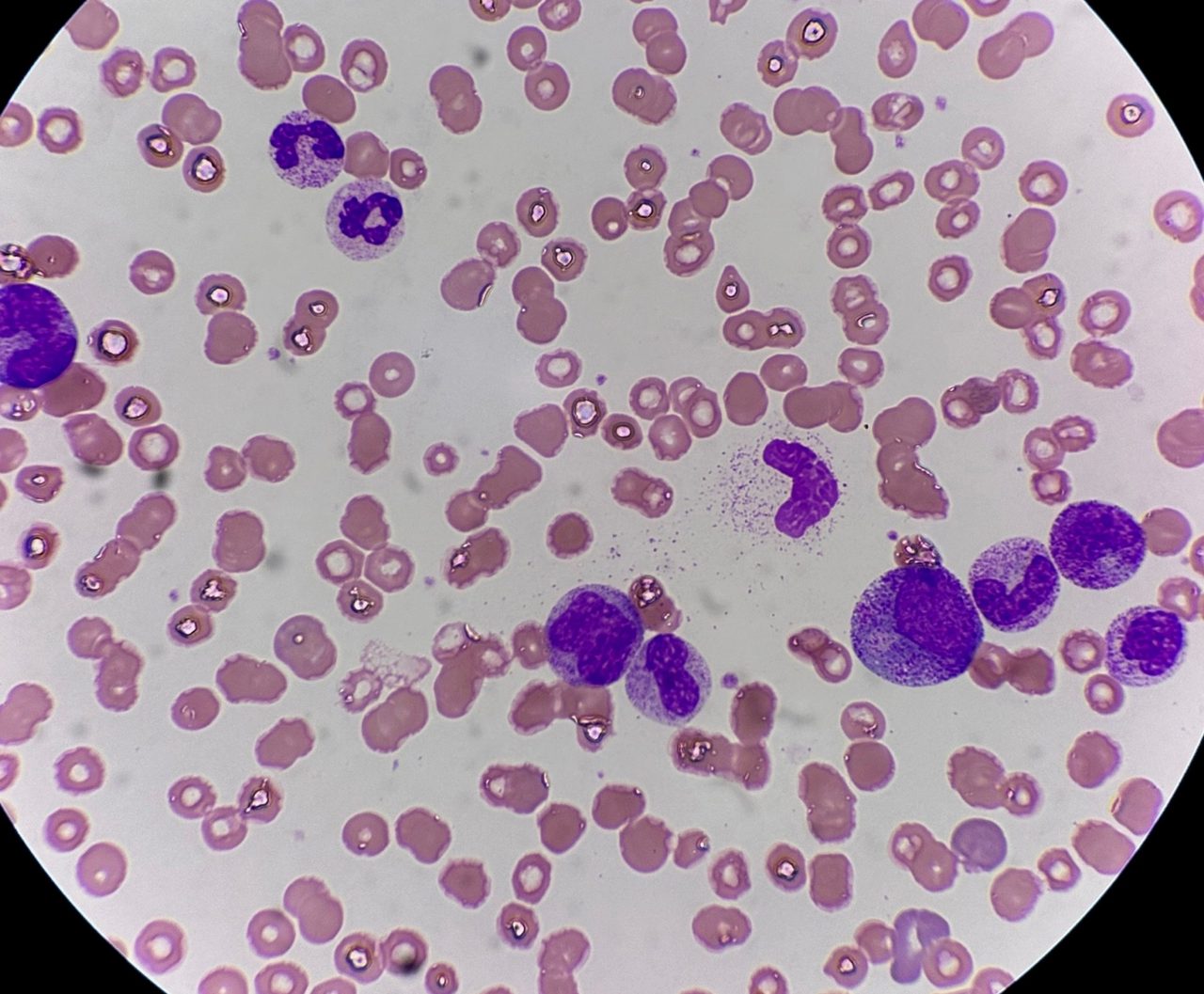 Granulocyte Morphology at Different Maturation Stages