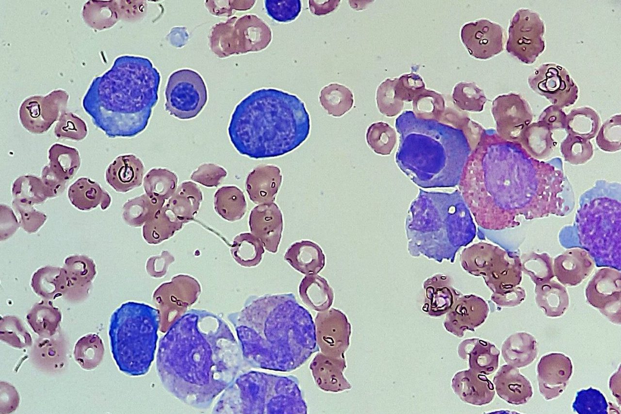 Bone Marrow Morphology: Assessing Cellular Composition