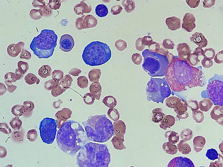 Bone marrow smear: erythroid and granulocytic series cells against a background of erythrocytes