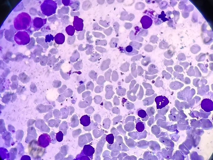 Bone marrow smear, erythroid cells of various maturation stages
