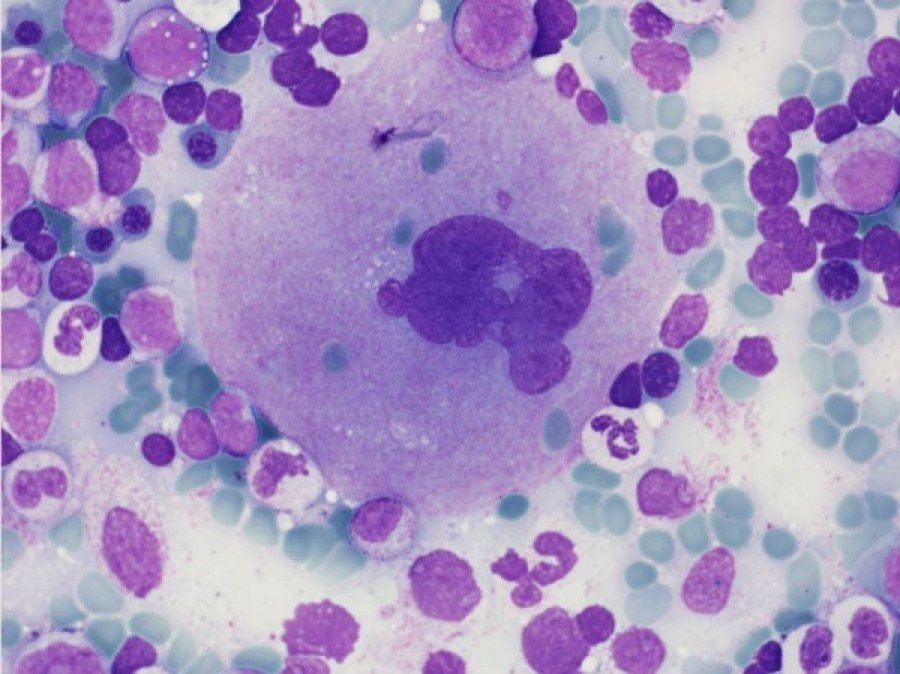 Megakaryocyte Morphology and Emperipolesis in Bone Marrow