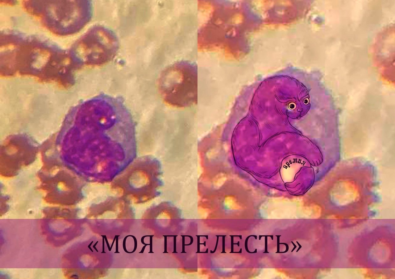 Морфология моноцита в мазке периферической крови