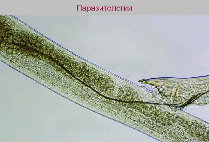 Микропрепарат: охват самки нематоды половой бурсой самца