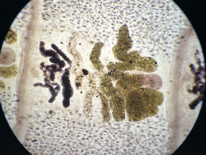 Microscopic specimen of a proglottid: rosette-shaped uterus filled with helminth eggs