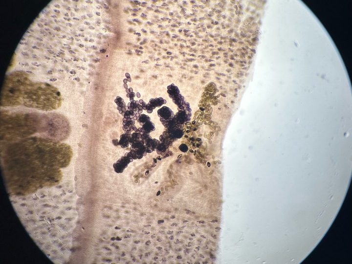 Microscopic specimen of a strobila: uterine loops with eggs in a mature proglottid of the parasite
