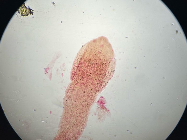 Microscopic specimen: scolex with bothria and neck of the broad tapeworm