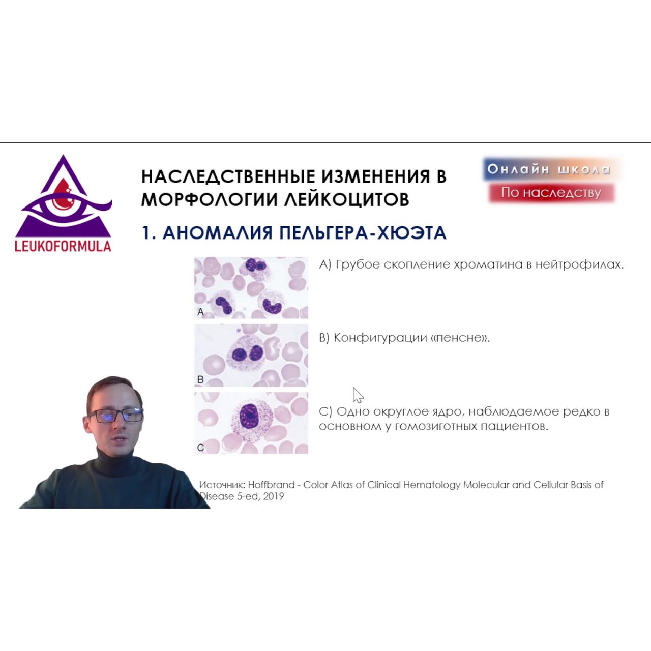 Наследственные аномалии морфологии лейкоцитов