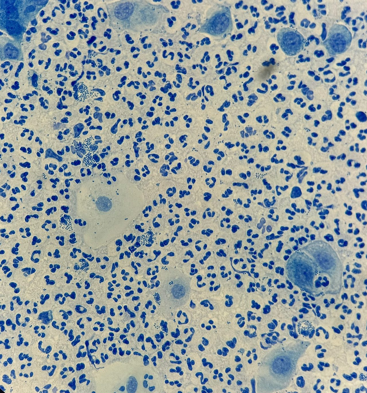 Neisseria gonorrhoeae в мазке из уретры: микроскопия