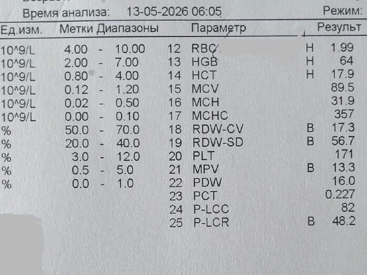 Распечатка анализатора: лейкоцитоз WBC 24,67×10⁹/л и анемия HGB 64 г/л