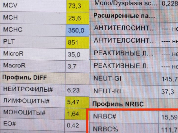 Экран гематологического анализатора с уровнем NRBC 111,7% и выраженной анемией