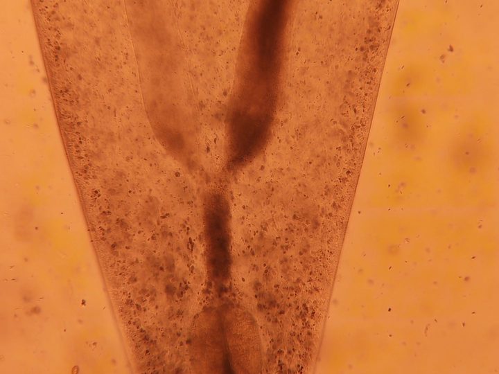 Opisthorchis under the microscope: end of the fluke's body with internal organs