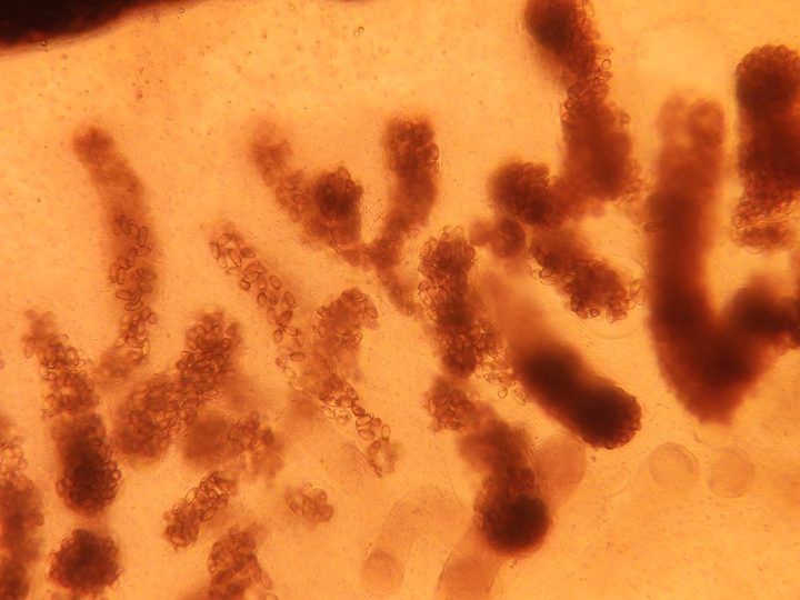 Uterine loops of Opisthorchis filled with eggs