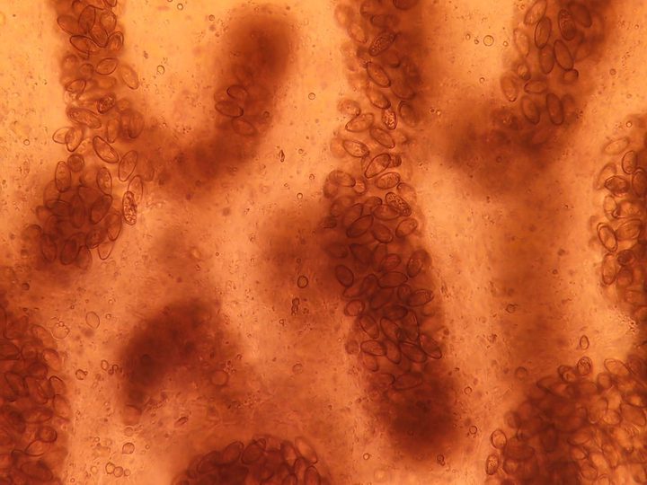 Opisthorchis eggs within the uterine loops, close-up