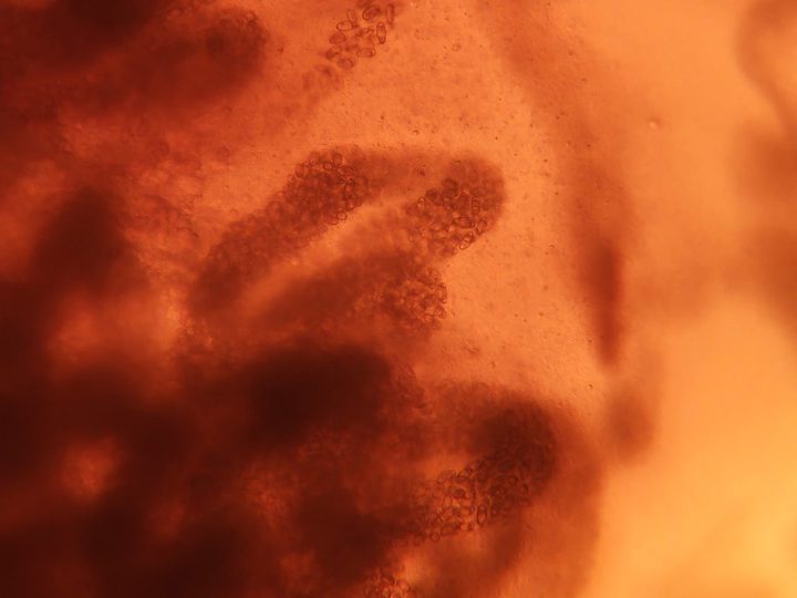 Egg-filled uterus of Opisthorchis, another field
