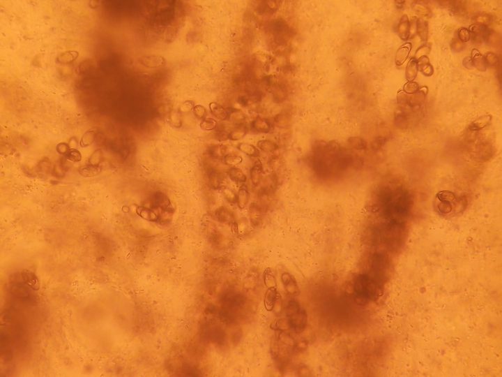 Individual Opisthorchis eggs along the uterine loops