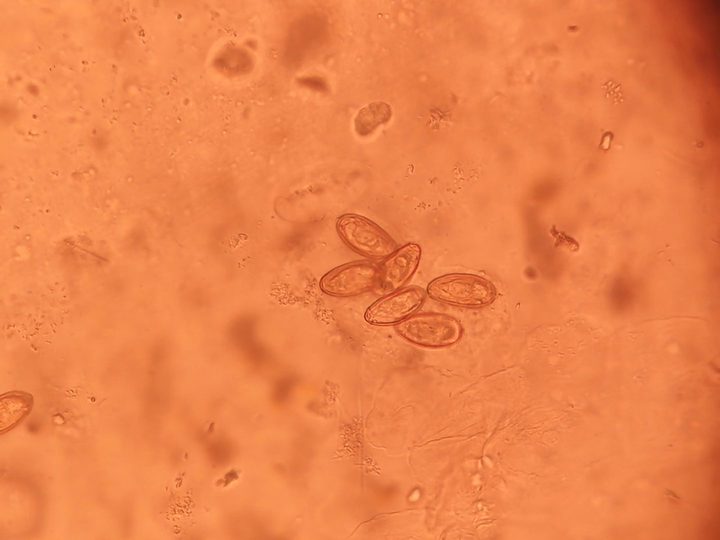 A cluster of Opisthorchis eggs under the microscope