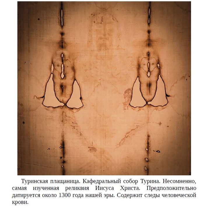 Photograph of a fragment of the Shroud of Turin with traces of blood