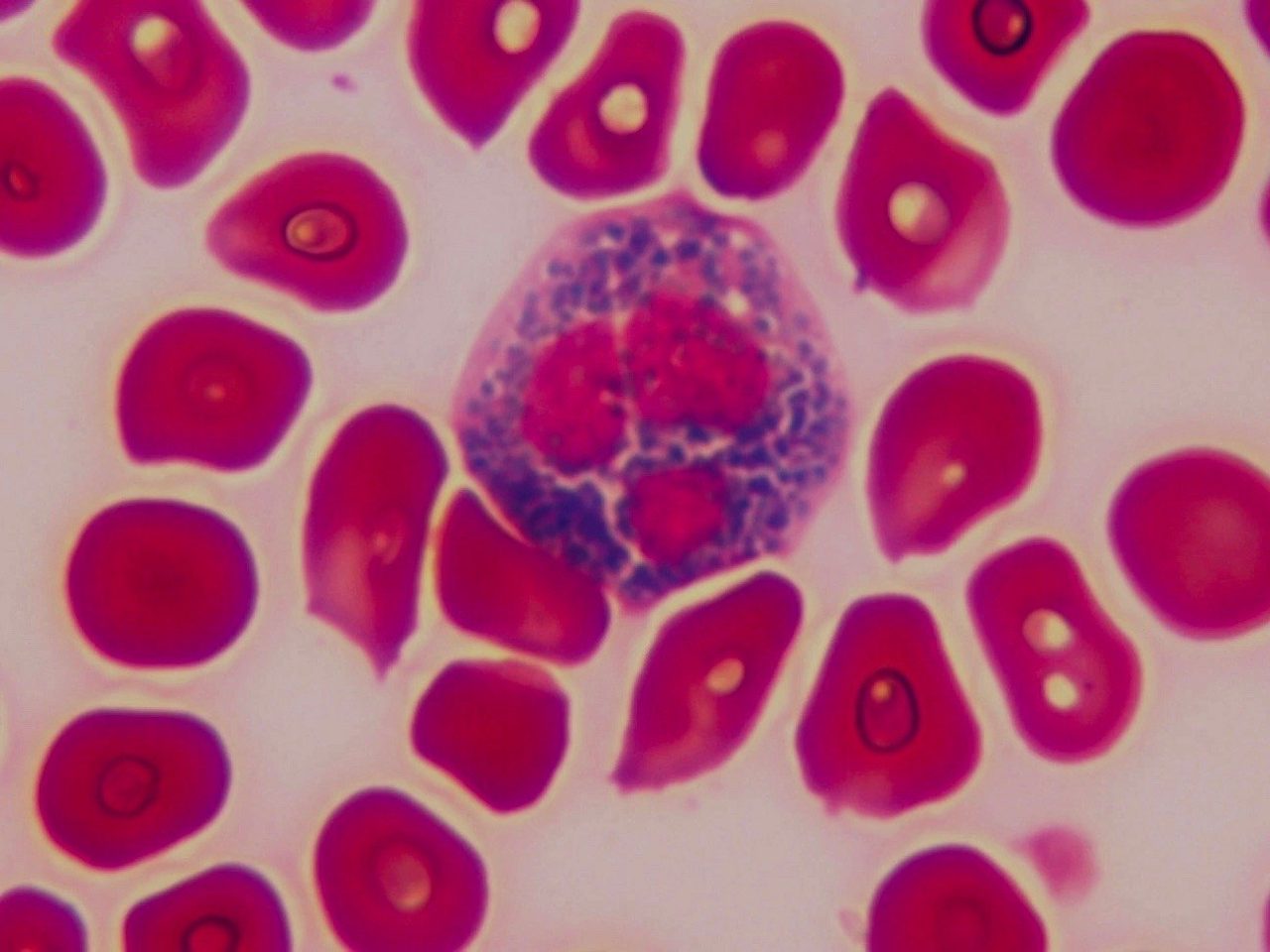 Shubich Method: Granulocyte Cationic Protein Detection