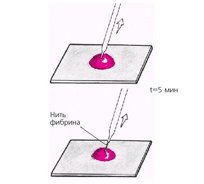 Scheme for determining blood coagulation time by Morawitz with fibrin thread formation