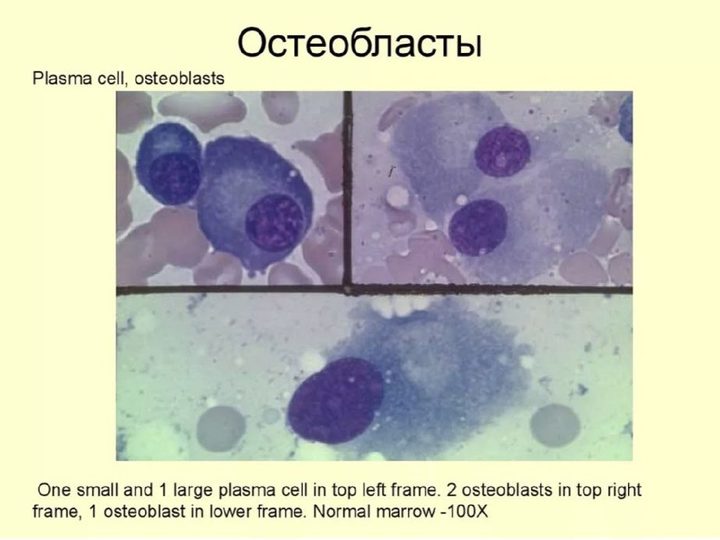 Справочная микрофотография, сравнение морфологии плазмоцитов и остеобластов