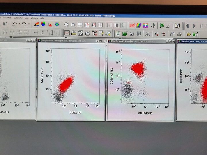 Flow cytometry: co-expression of CD19, CD10, and CD34 markers
