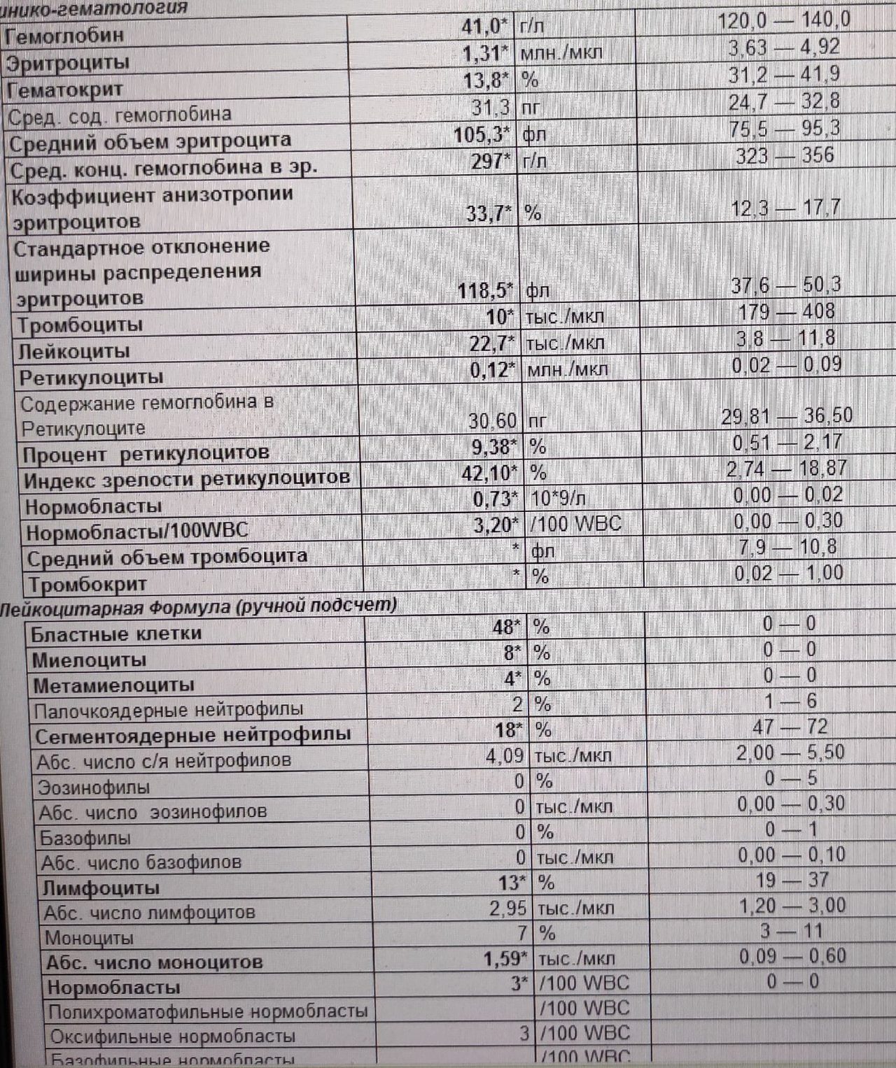 Острый лейкоз: 48% бластов в периферической крови