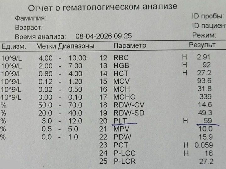 Распечатка гематологического анализатора: панцитопения у пациента