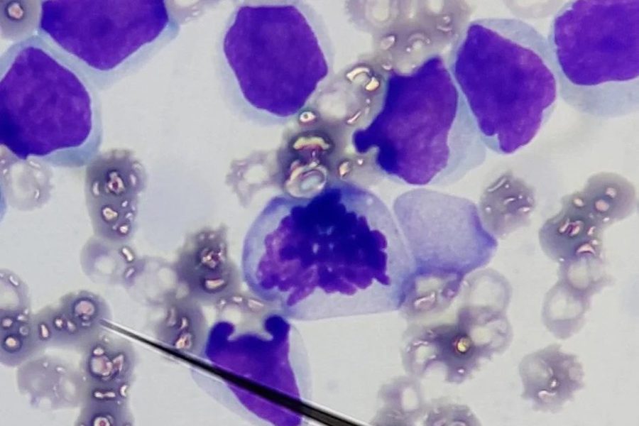 Canine Acute Lymphoid Leukemia: Blast Morphology