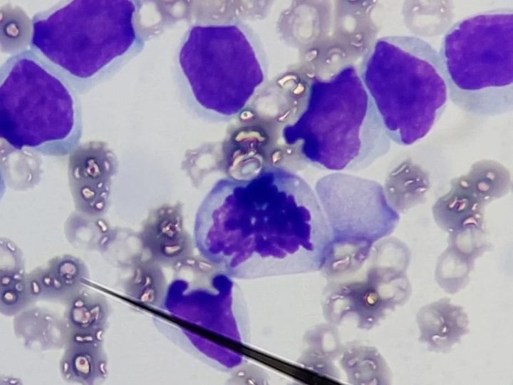 Dog blood smear: lymphoblasts and a mitotic figure in the center of the field of view