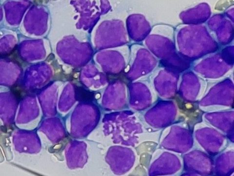Dog blood smear: dense cluster of blasts and several mitotic figures