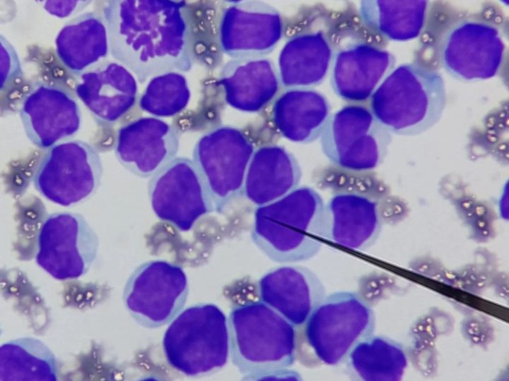 Dog blood smear: pronounced blastemia and a cell division figure