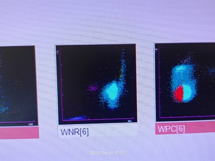 Analyzer printout: WDF, WNR, and WPC channel scattergrams with blasts