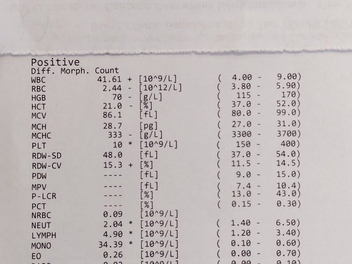Распечатка анализатора: лейкоцитоз 41,61×10⁹/л и тромбоцитопения 10×10⁹/л