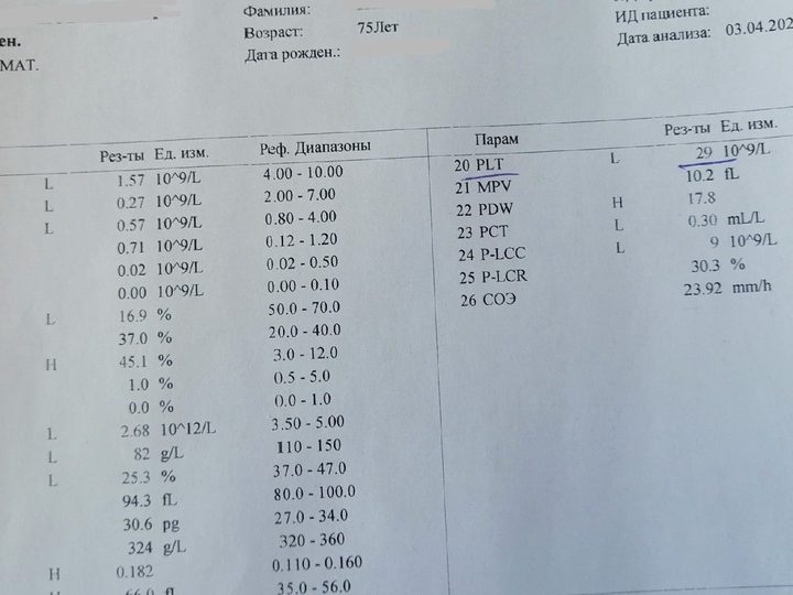 Распечатка анализатора: WBC 1,57×10^9/л, HGB 82 г/л, PLT 29×10^9/л