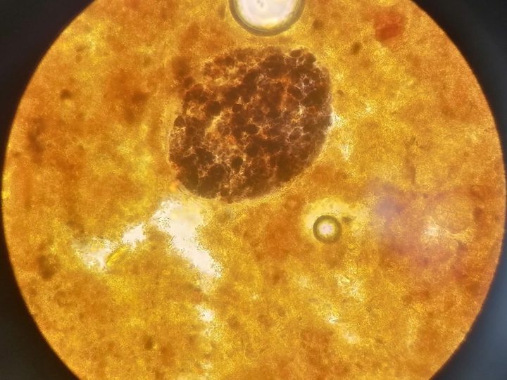 Native stool sample: digestible fiber cell with starch