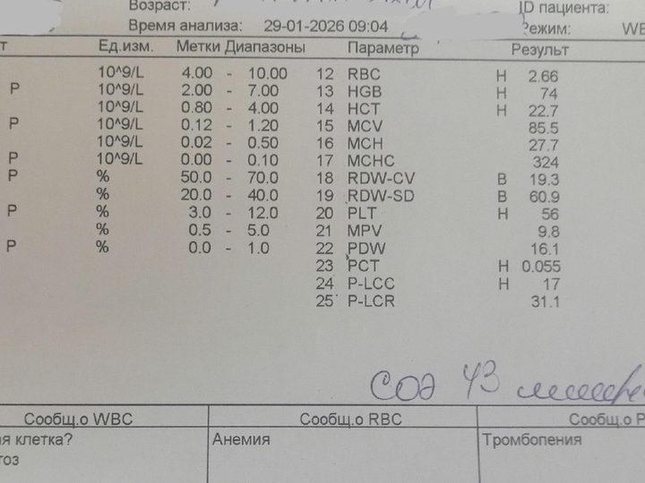 Analyzer printout: anemia with HGB 74 g/L and thrombocytopenia 56×10⁹/L