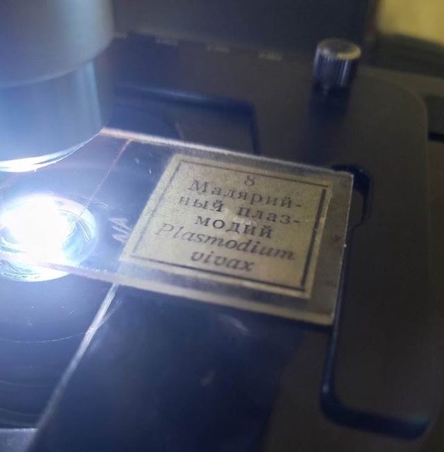 Мазок крови от 1970 г. с Plasmodium vivax