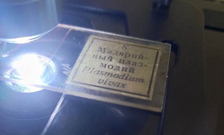 Общий вид мазка крови