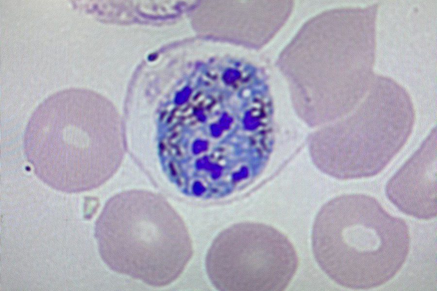 Plasmodium vivax в мазке крови: морфология стадий развития