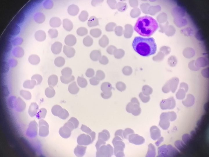 Blood smear: segmented neutrophil and plasma cell in the field of view