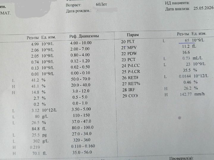 Бланк анализа крови, анемия HGB 80 г/л, тромбоцитопения PLT 65×10⁹/л и высокое СОЭ