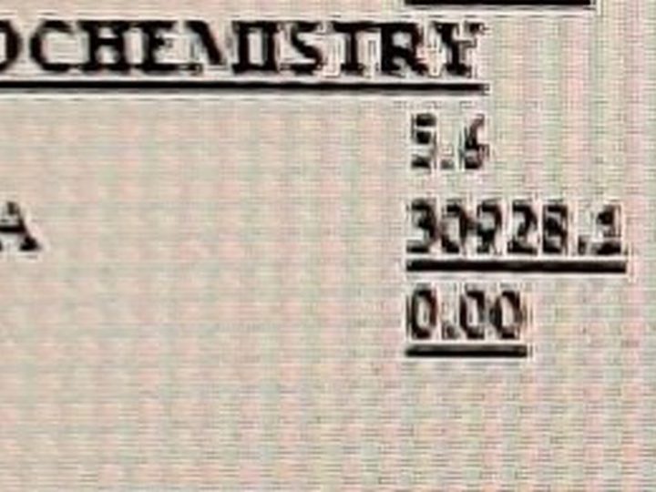 Analysis form: sharp increase in free lambda light chains to 30928.1 mg/L