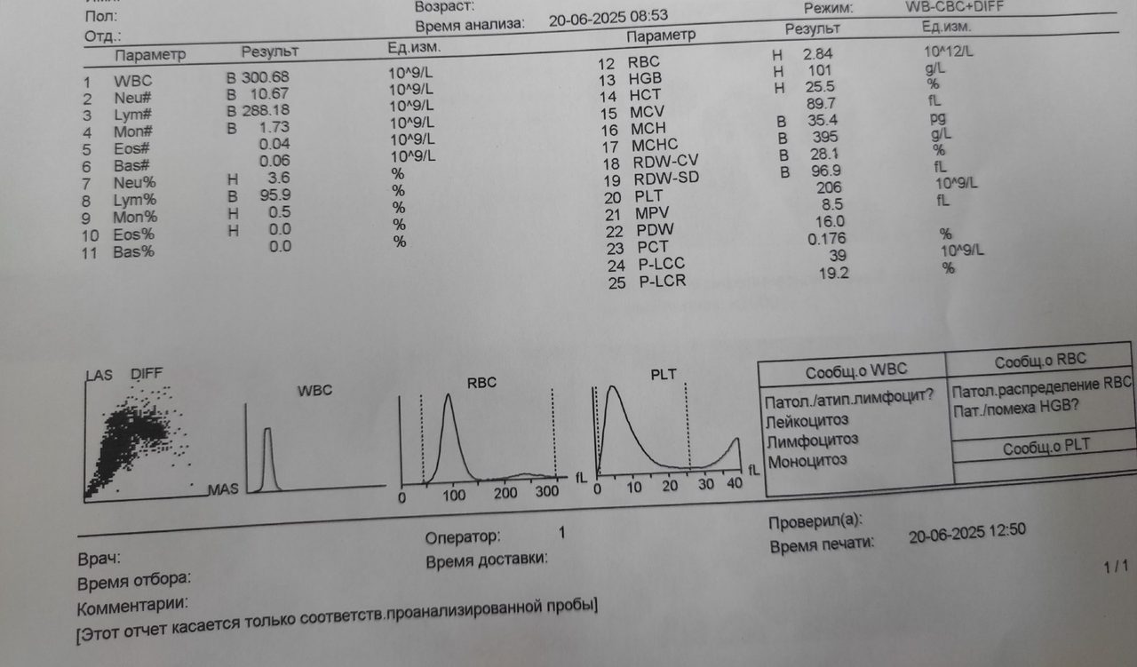 Подозрение на волосатоклеточный лейкоз при гиперлейкоцитозе
