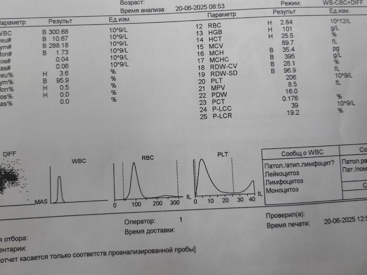 Распечатка гематологического анализатора: лейкоцитоз 300,68 × 10⁹/л и лимфоцитоз 95,9%